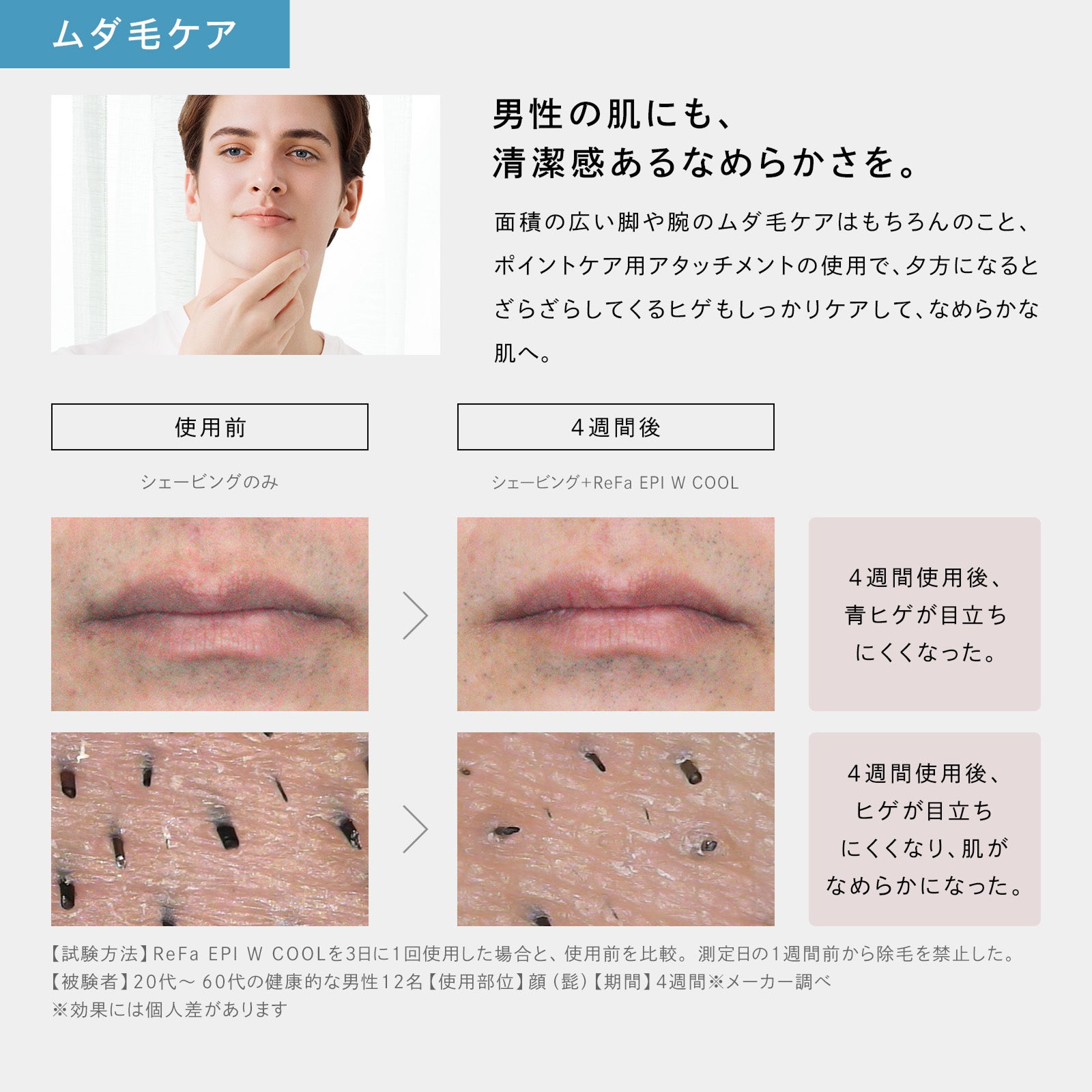 [レンタル] MTG ReFa EPI W COOL リファ エピ ダブルクール - 3