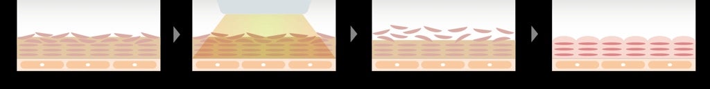 [レンタル] MTG ReFa EPI W COOL リファ エピ ダブルクール - 8