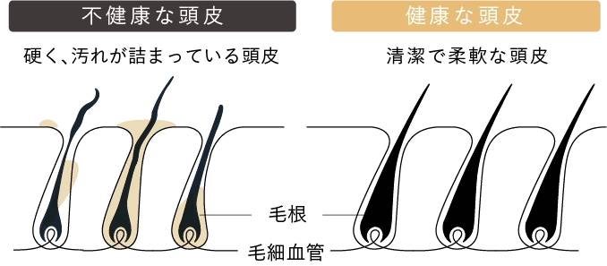 [レンタル] MYTREX(マイトレックス) HEAD SPA DEEP X ヘッドスパ 美顔器 - 2