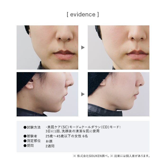 [レンタル] STELLA BEAUTE(ステラボーテ) IPL&NIR光美容器 PRO - 15