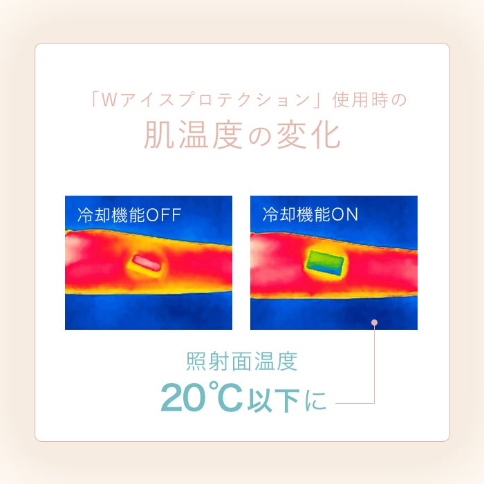 [レンタル] STELLA BEAUTE(ステラ ボーテ) IPL光美容器 Luna - 14