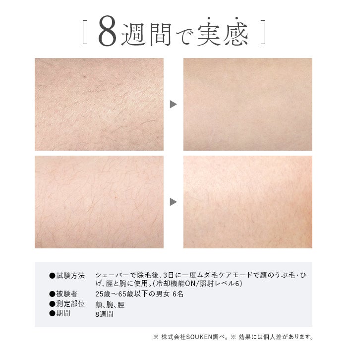 [レンタル] STELLA BEAUTE(ステラボーテ) IPL&NIR光美容器 PRO - 6