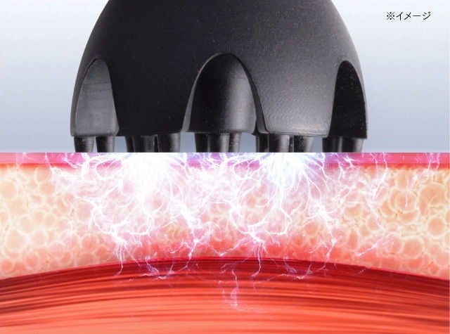 [レンタル] MYTREX(マイトレックス) HEAD SPA DEEP X ヘッドスパ 美顔器 - 5