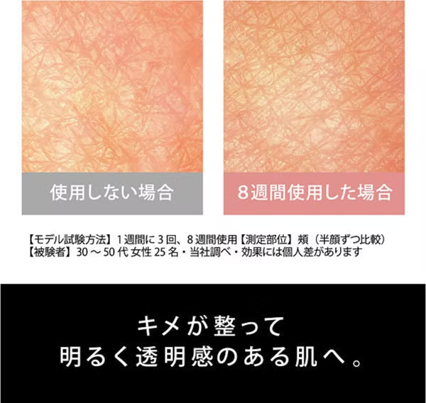 [レンタル] パナソニック 光美顔器 フォト ブライトショット EH-SL85 - 5