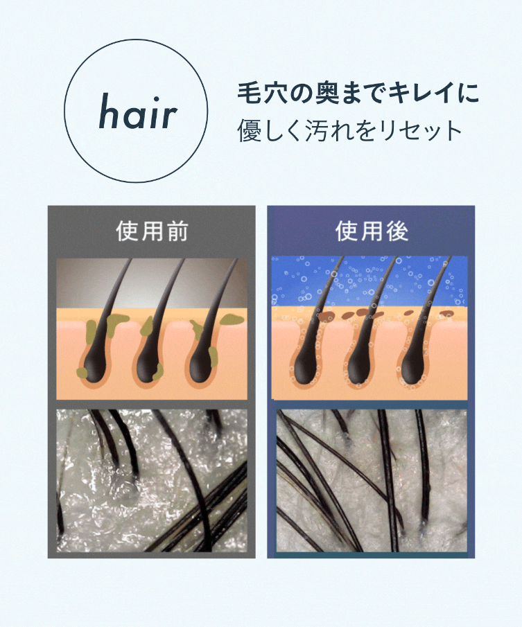 [レンタル] 【増圧版】Noend オーガニックファインバブルシャワーヘッド - 5