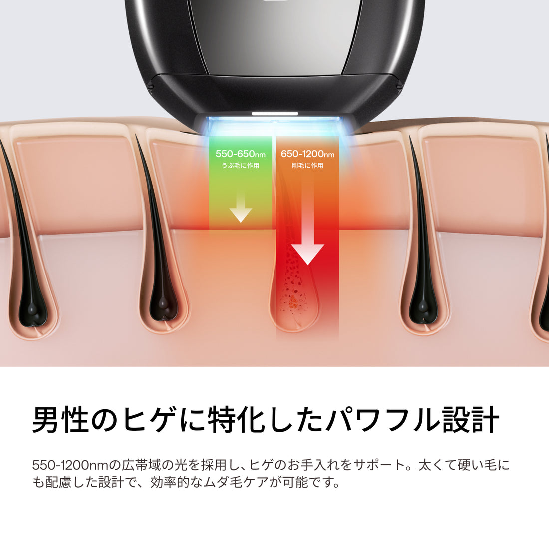 [レンタル] ユーライク(Ulike) X Max IPL光美容器 2026年モデル - 4