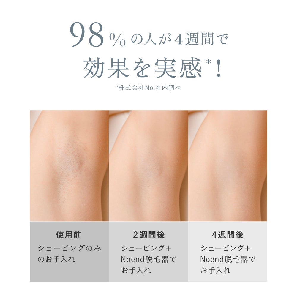 [レンタル] Noend コードレス光美容器 - 4