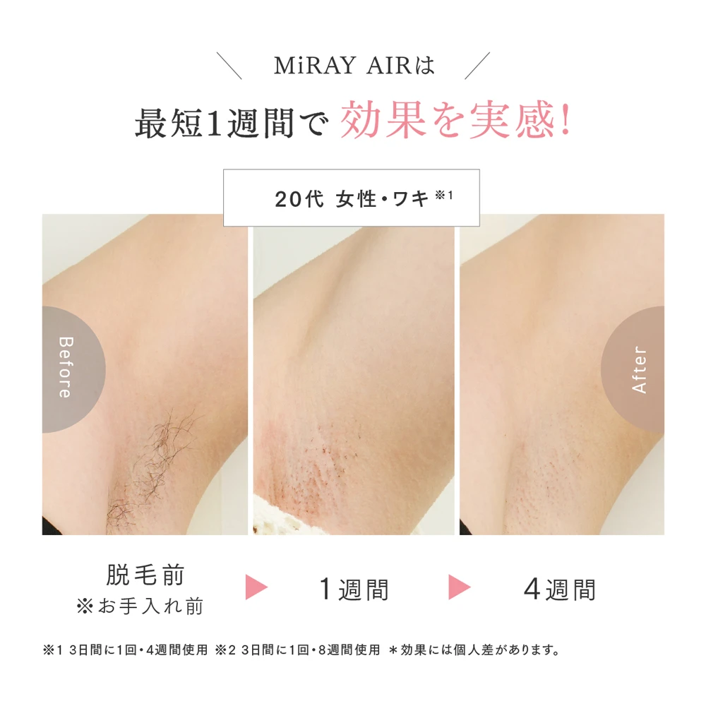 レンタル] MYTREX(マイトレックス) MIRAY AIR ホワイト - Rentio