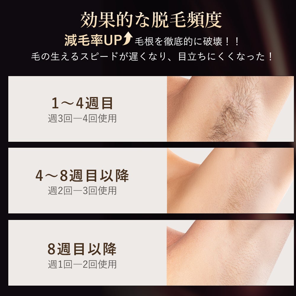 [レンタル] ANLAN ZAP 光美容器 - 12