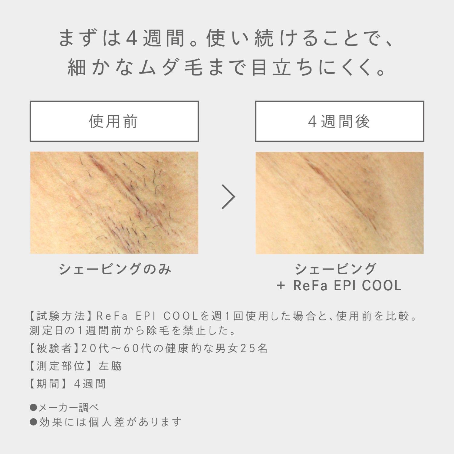 [レンタル] MTG ReFa EPI COOL リファ エピ クール - 6