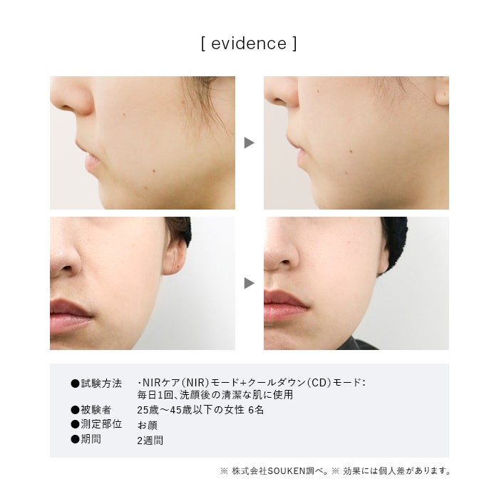 [レンタル] STELLA BEAUTE(ステラボーテ) IPL&NIR光美容器 PRO - 13