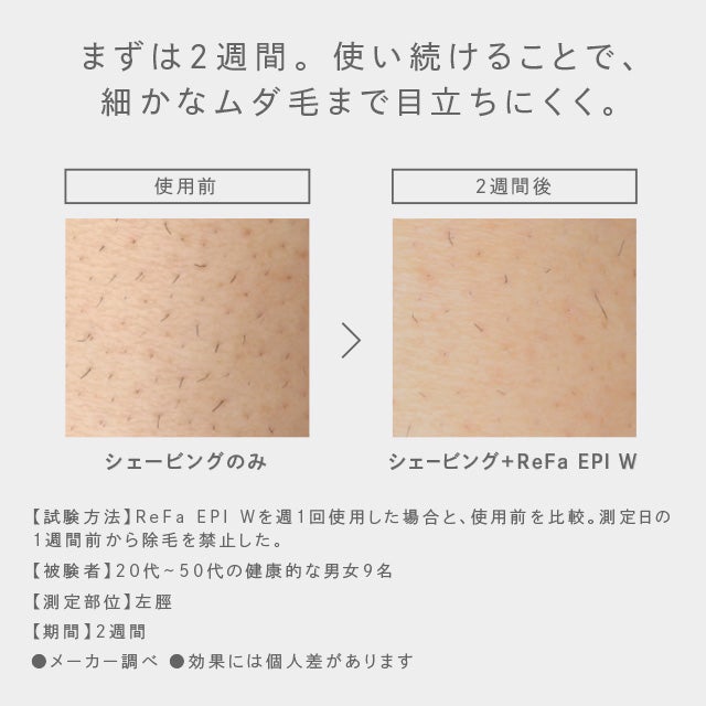 [レンタル] MTG Refa EPI W リファエピダブル 光美容器 - 9