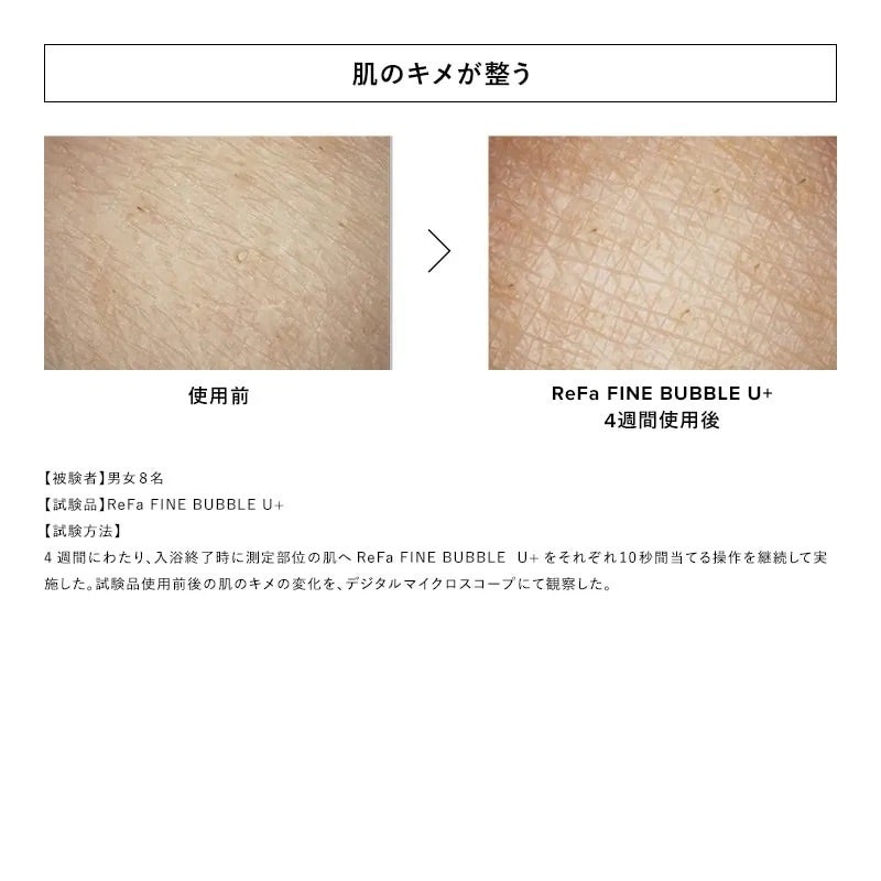 [レンタル] MTG Refa FINE BUBBLE U+ リファファインバブル U+ - 6