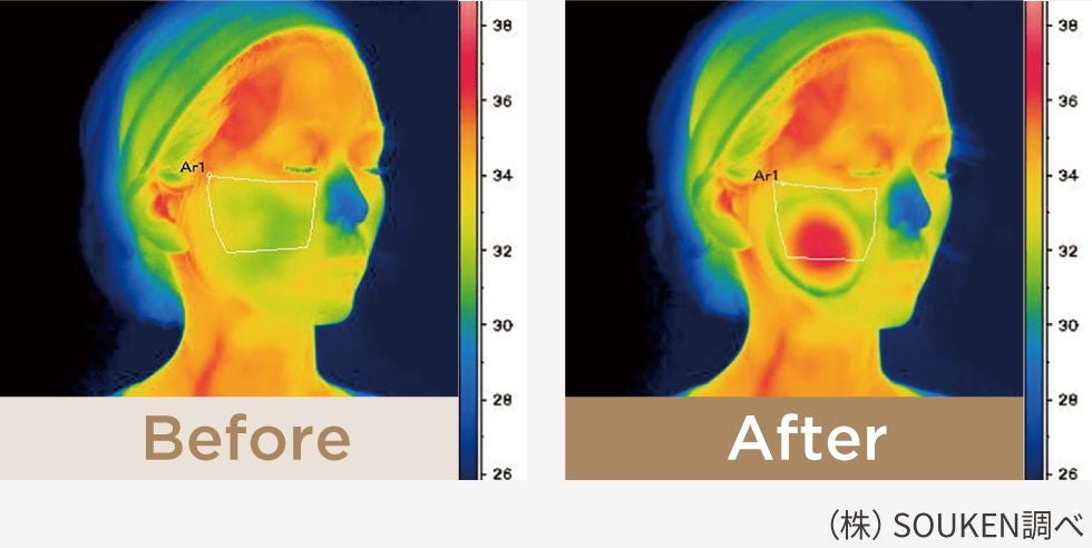 [レンタル] ヤーマン フォトプラスディープリフト - 4