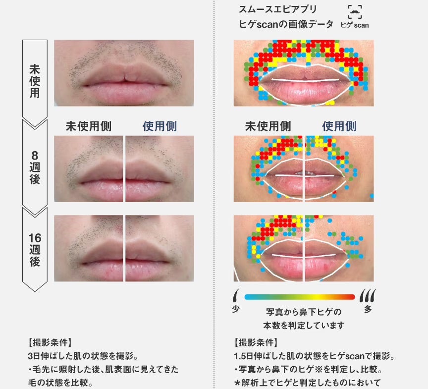 [レンタル] パナソニック 光エステ スムースエピ パワー＆クール ES-WG0B 光美容器 - 8